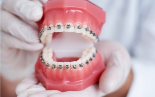 Orthodontie - Tandarts Himmi